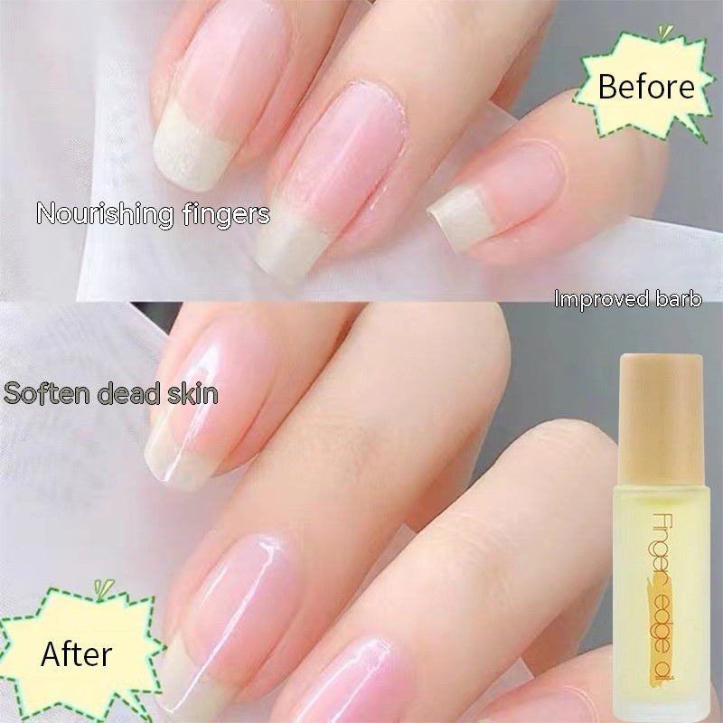 Finger Edge Oil Nail Base Coat Nutrient Solution Anti-agnail