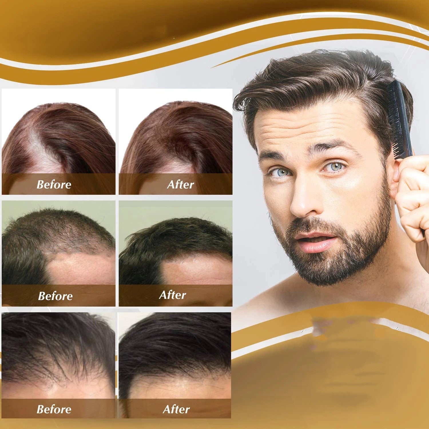 iBeaLee Anti Hair Loss Hair Nourishing Liquid Hair Firming And Hair Increasing