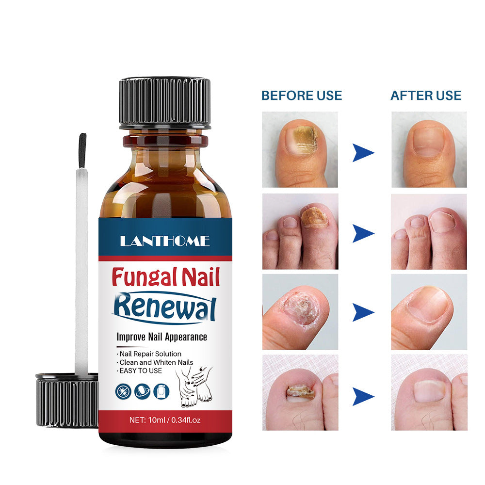 Lanthome Nail Liquid Mildly Moisturizing Nail Repair Liquid