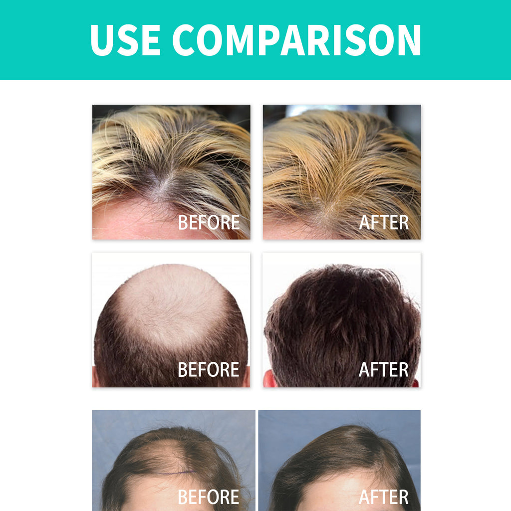Ouhoe Dense Hair Ball Strong Hair Care