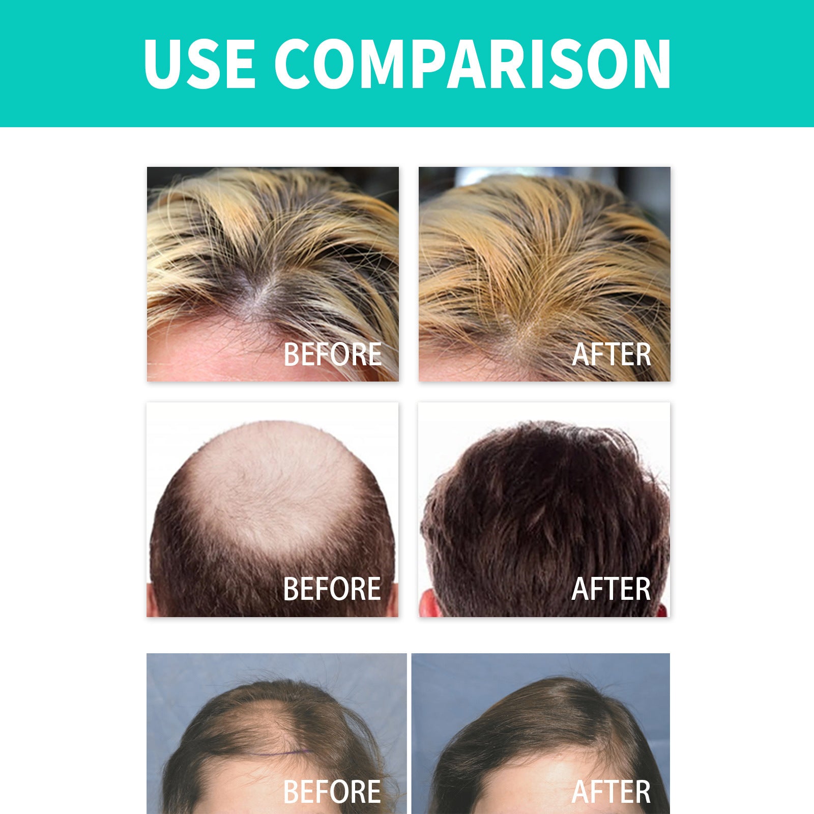 Ouhoe Dense Hair Ball Strong Hair Care