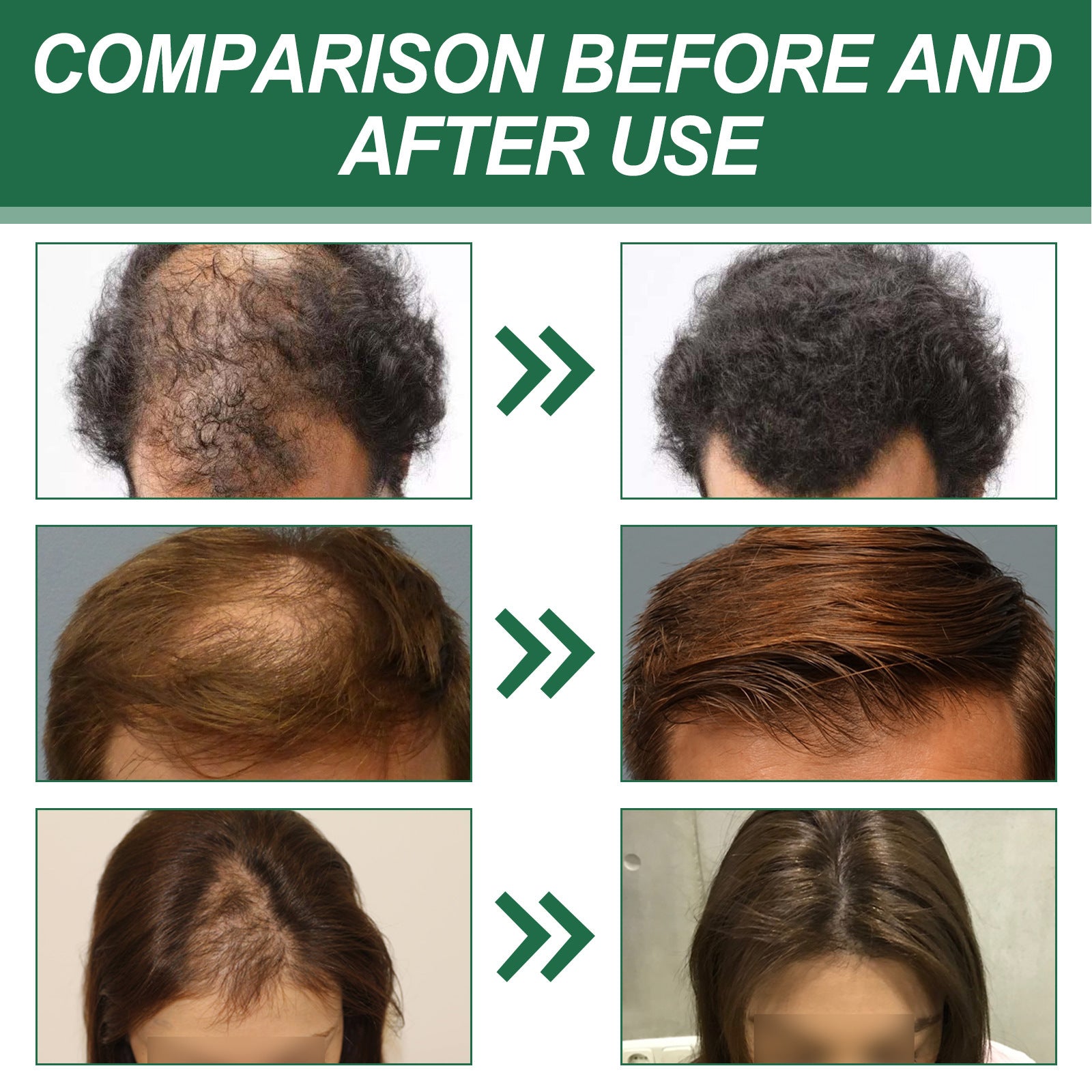 East Moon Anti-hair Fixing And Tough Massage Hair Care Spray