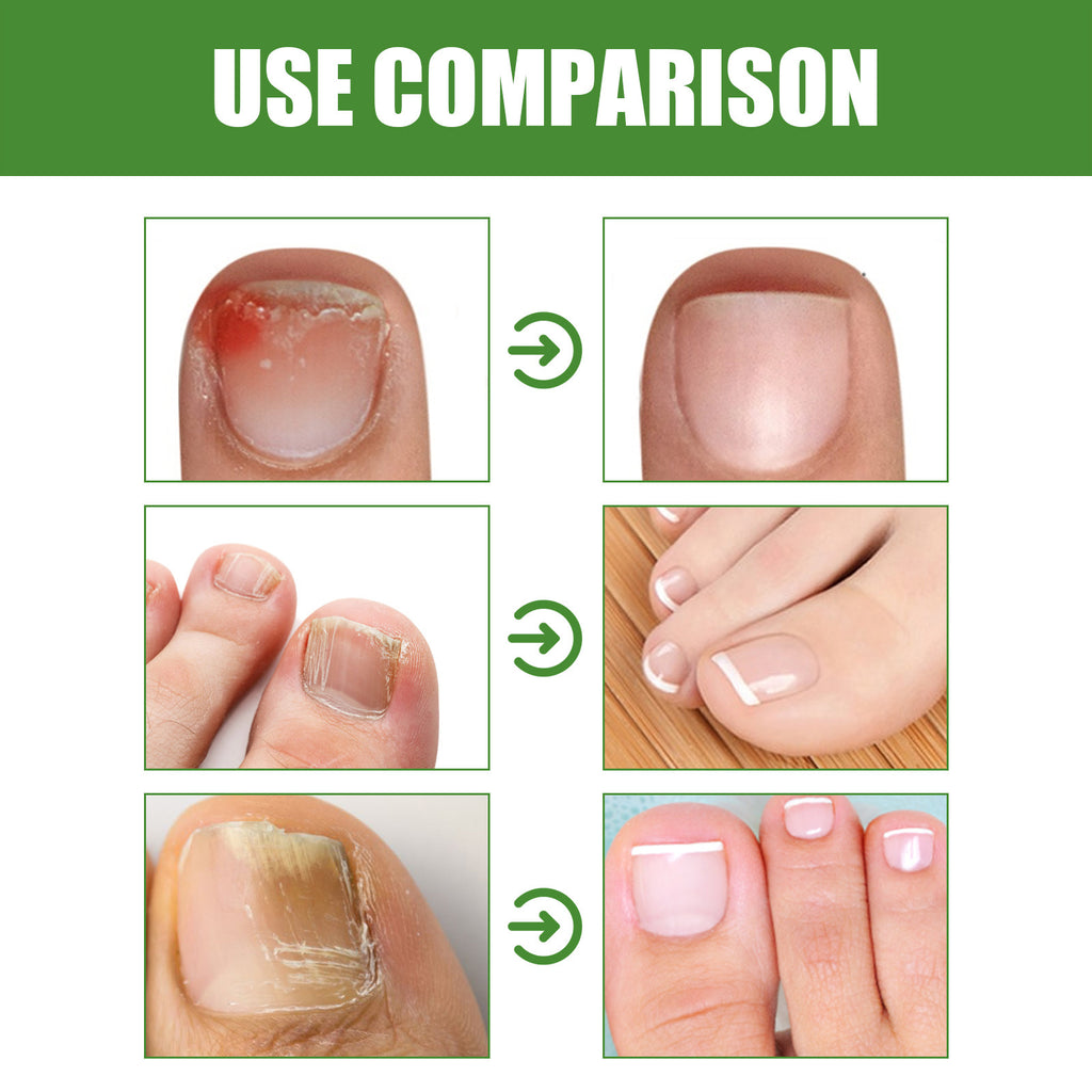 South Moon Ball Massage Moisturizing Nail Care