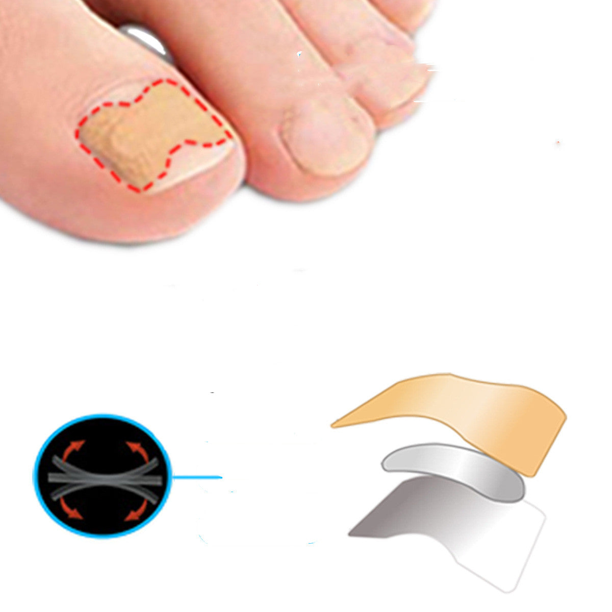 So Easy Inlay Nail Paste Double-sided Tape Inlay Nail Corrector Tool