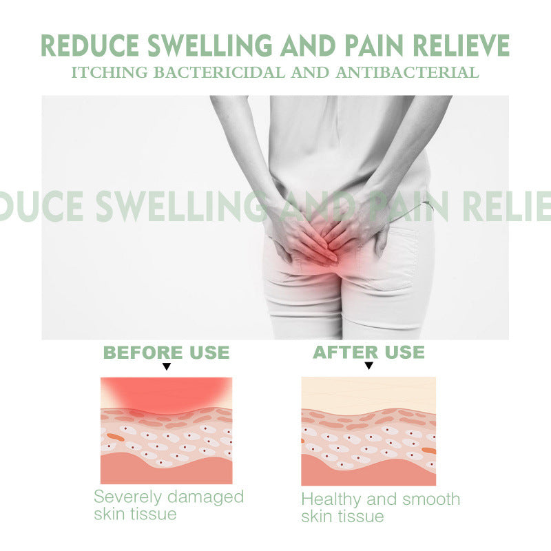 Body Care Cream For Repairing Perianal Skin