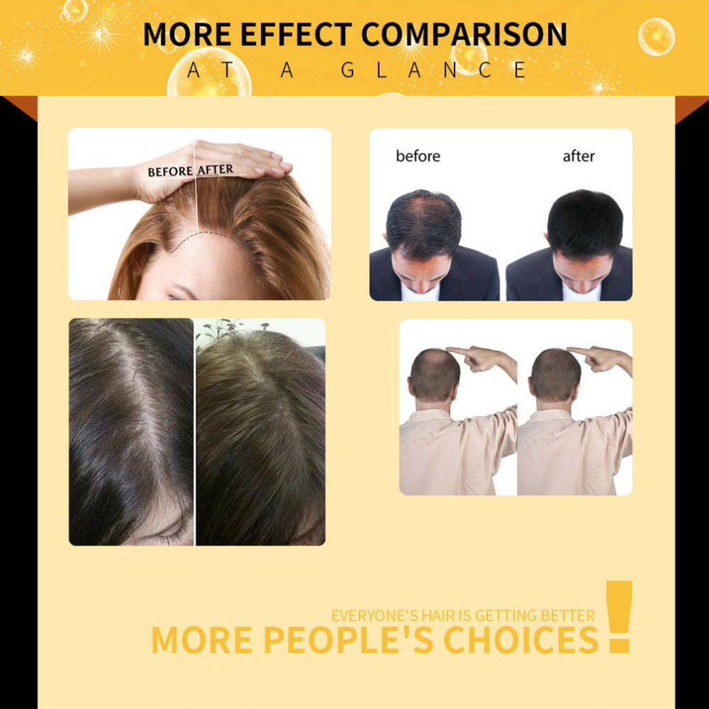 Lavdik Damaged Hair Repair Women Men's Fast Hair Growth Essence Oil Anti-hair Loss Lotion