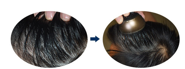 Comb with medicine artifact on scalp