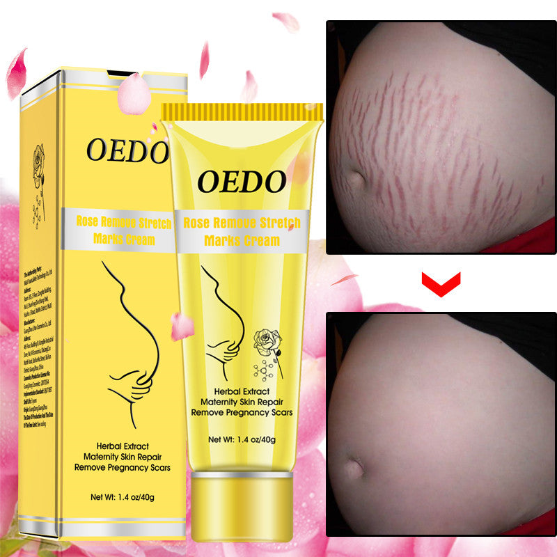 Rose go to stretch marks cream
