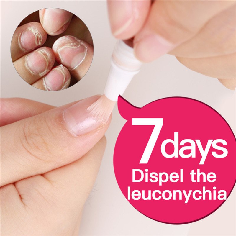 Limonsa Hand and foot nail care pen
