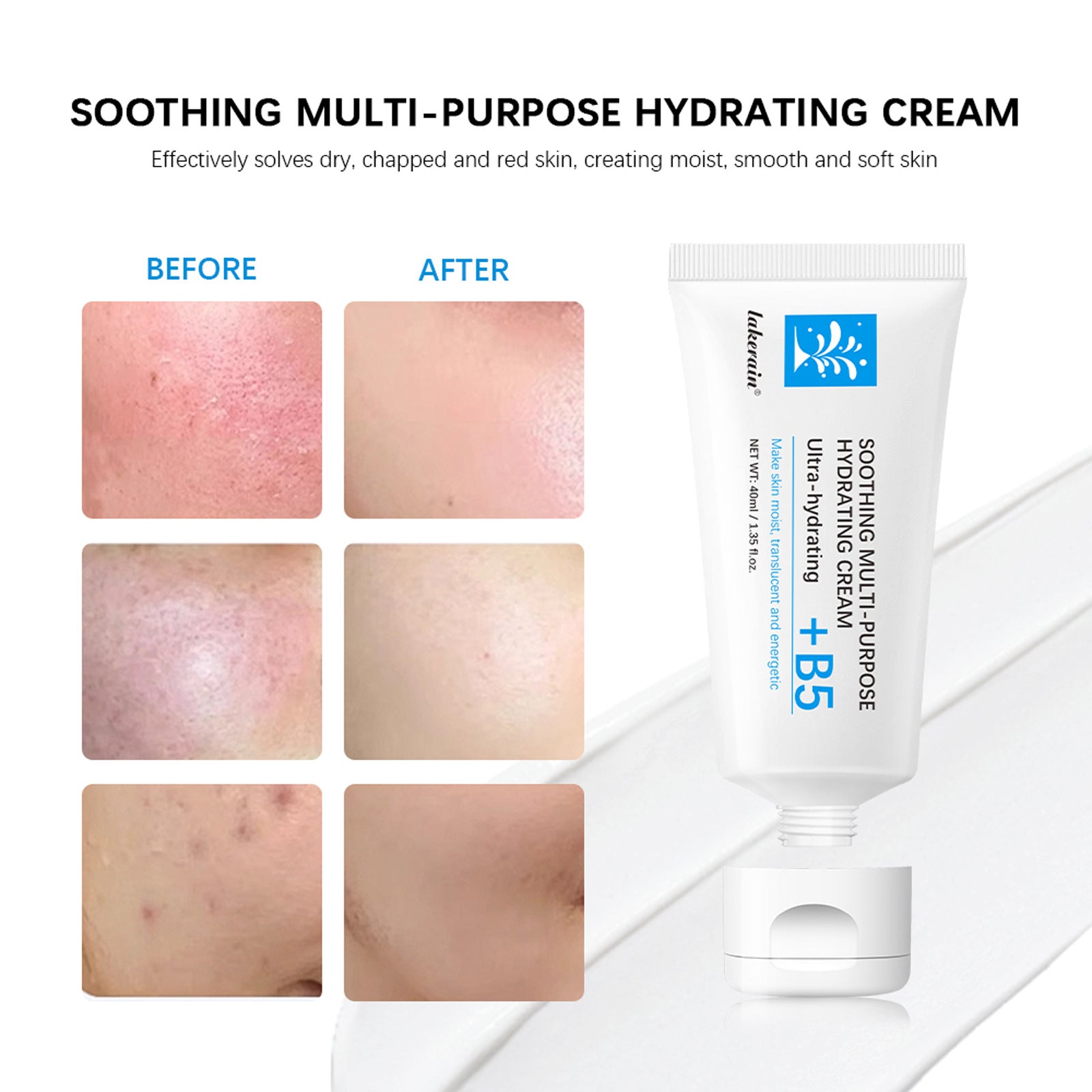 B5 Face Moisturizing Cream Dry