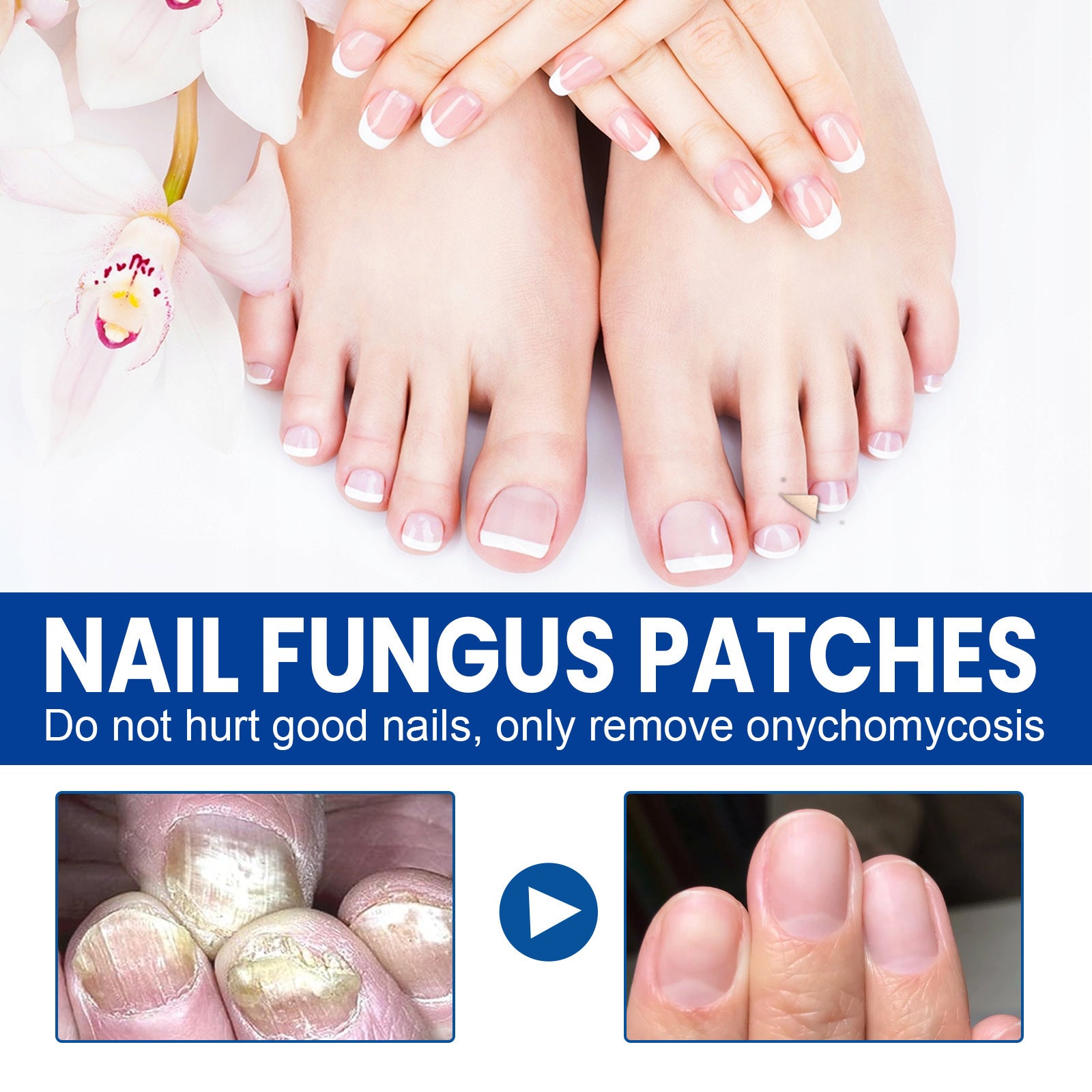 Ximonth Nail Nursing Adhesive Bandage Repair