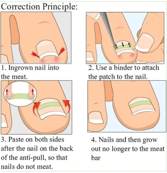 Ginail Nail patch