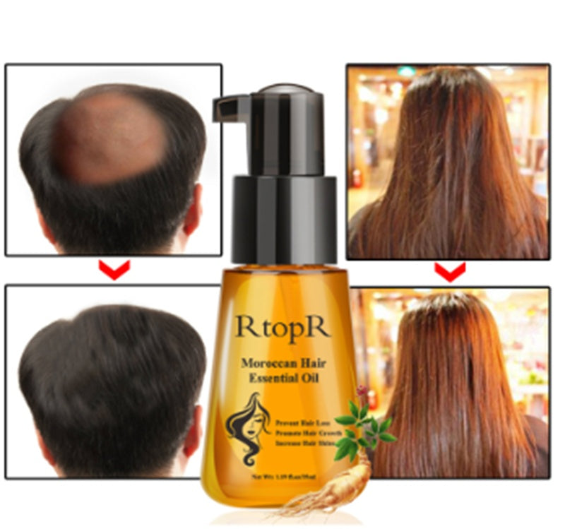 RtopR Anti-hair Loss Product Moroccan Hair Essential Oil 35ml