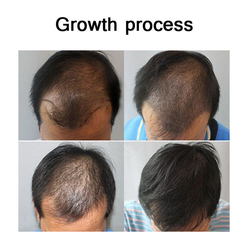 Miracle Hair Care Essential Oil Conditioner Hair Growth Essential Oil