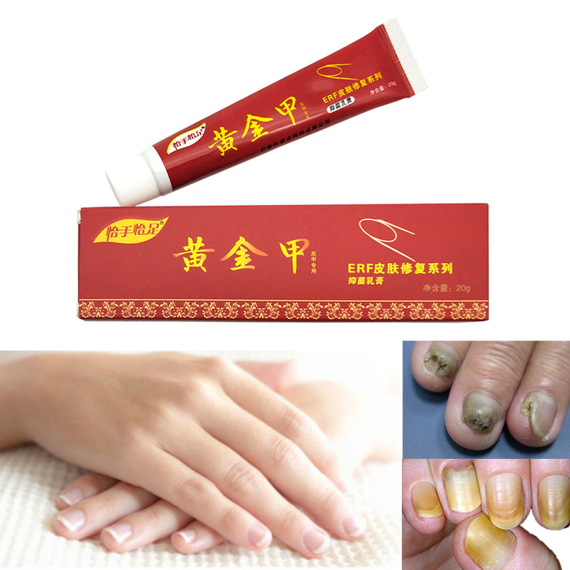 Yishou Yizu Golden Nail Care Cream 20g
