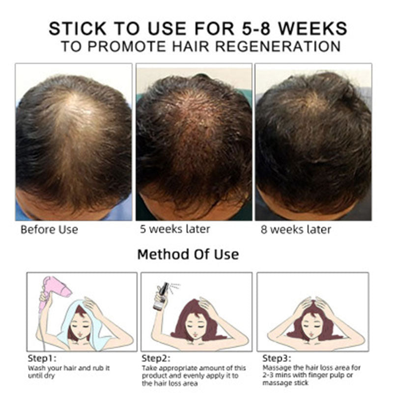 GZBITYHN Hair Growth Oil Hair Growth Oil Oem Hair Care Essential Oil