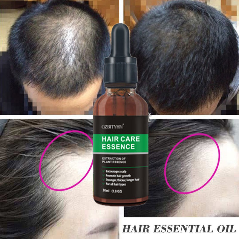 GZBITYHN Hair Growth Oil Hair Growth Oil Oem Hair Care Essential Oil