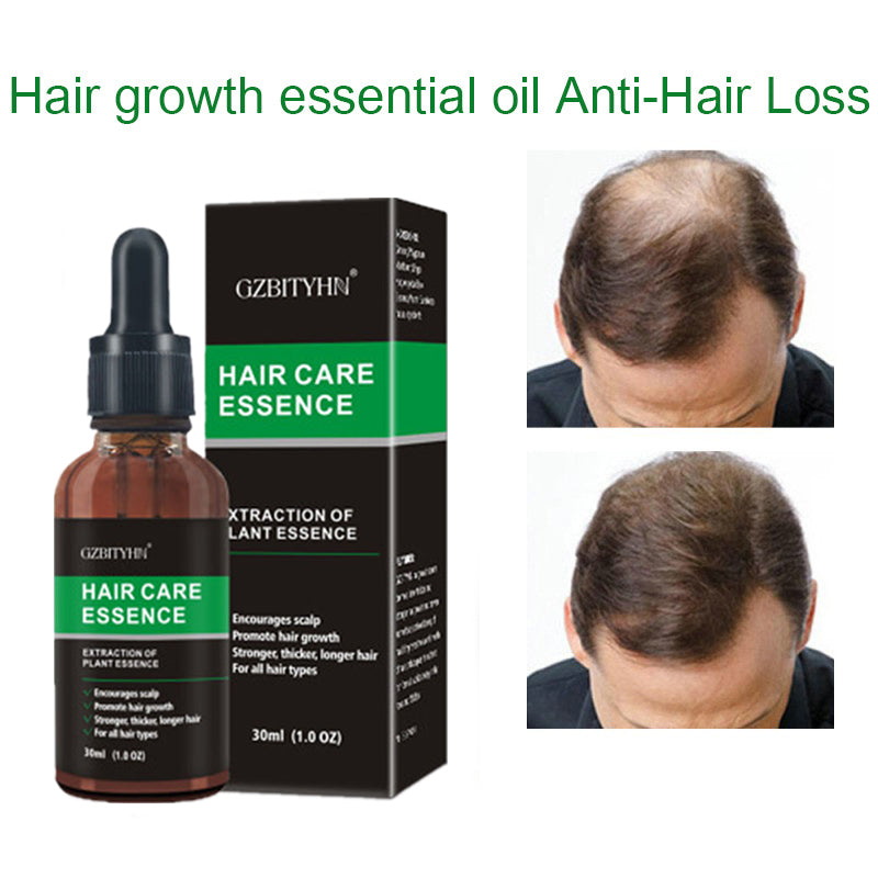 GZBITYHN Hair Growth Oil Hair Growth Oil Oem Hair Care Essential Oil