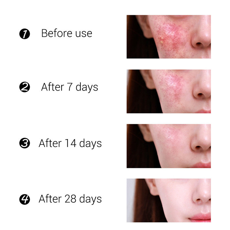 Tea Tree Bean Cream Moisturizing Treasure Wet Qudouyin Cream
