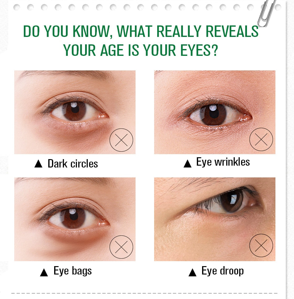 1 Anti Dark Circle Eye Cream