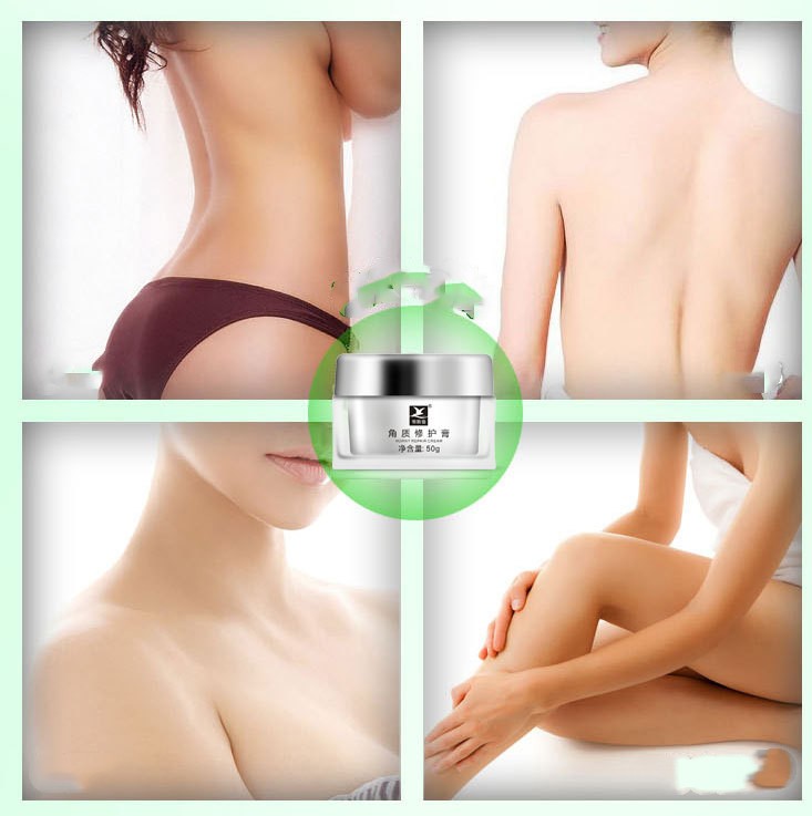 Soothing cream to exfoliate chicken skin pimples