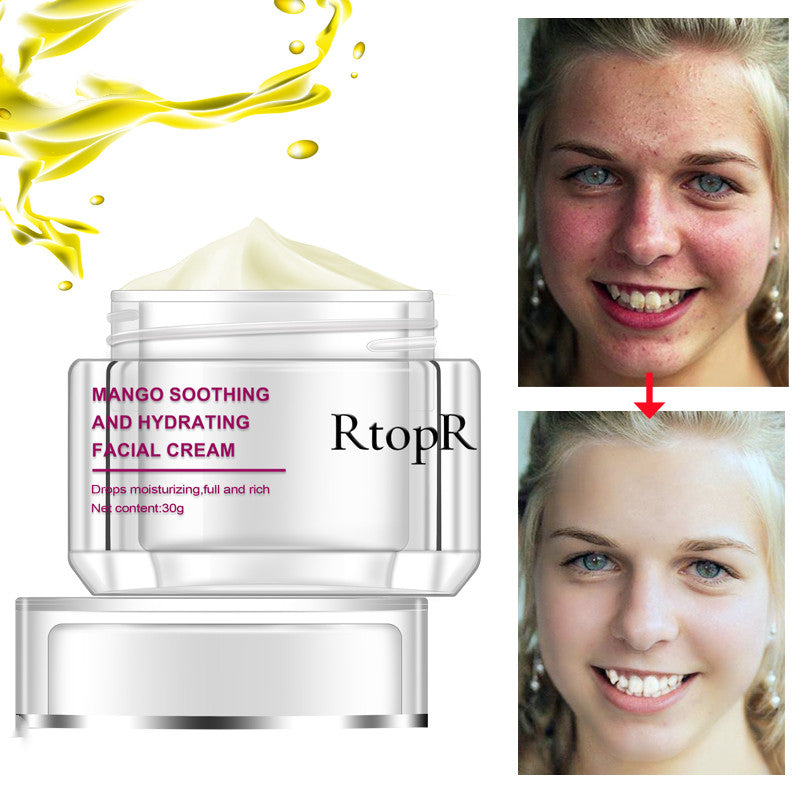 RtopR Cream RtopR001