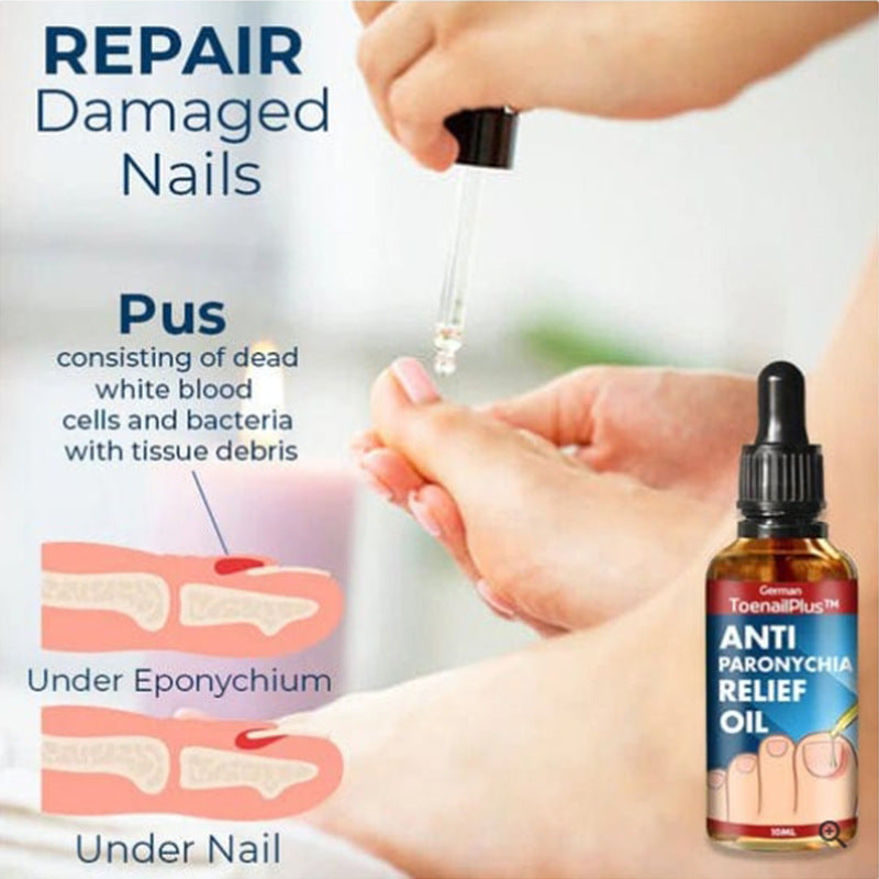 ToenailPlus Bright Nail Repair Thickened Nail Groove Treatment Oil