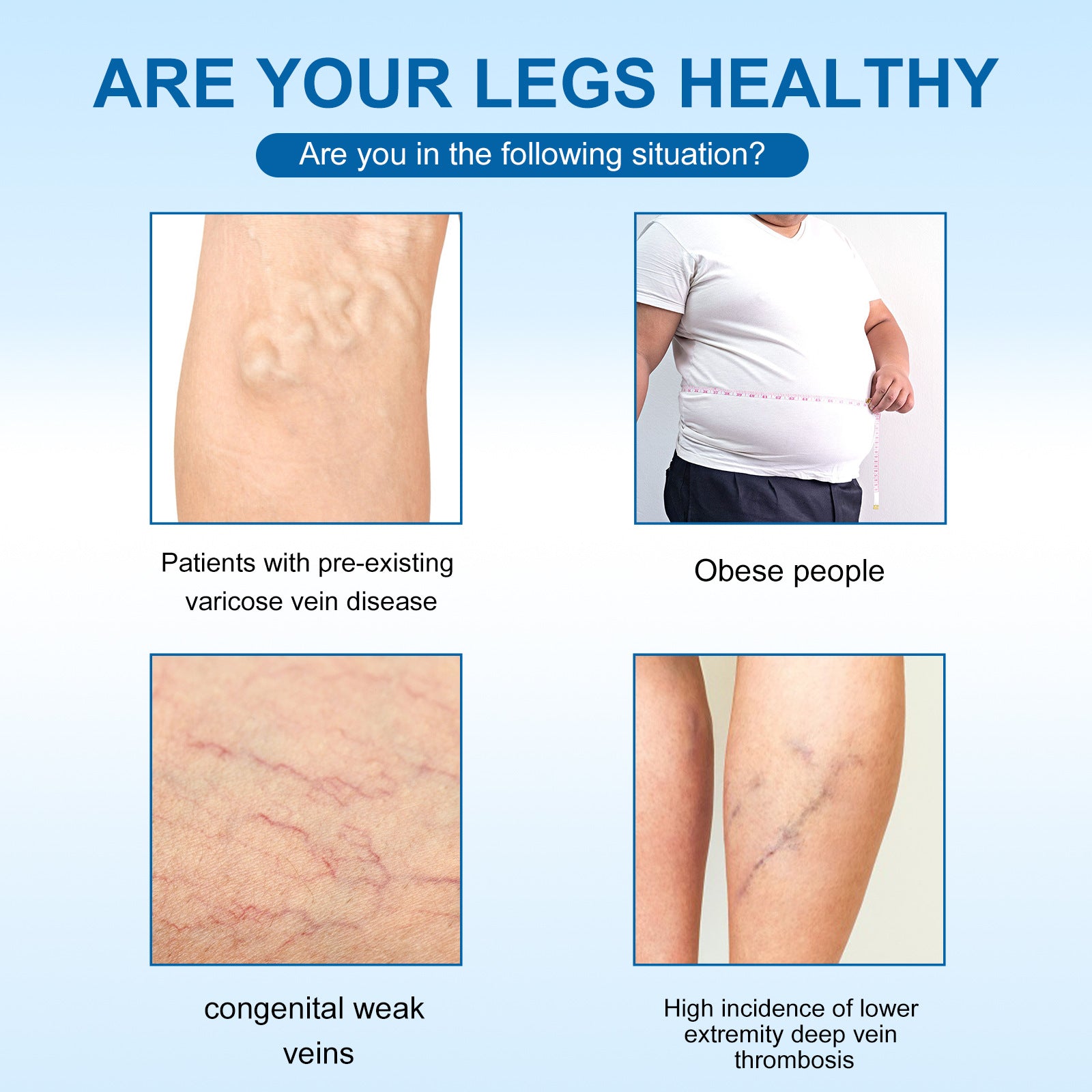 OUHOE Vein Slimming Cream Vein Repair Body Care