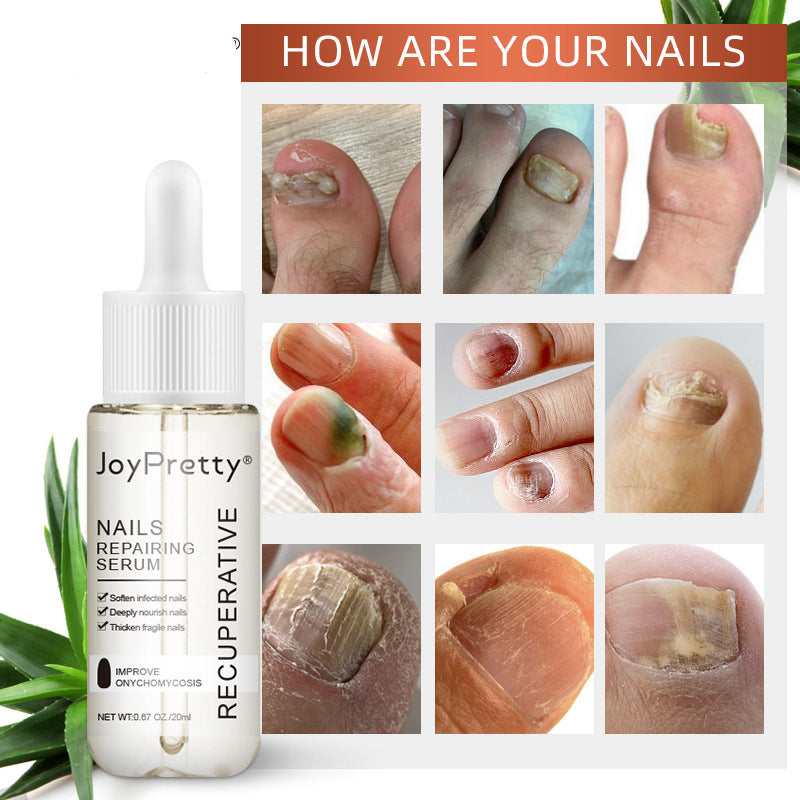 Joy Pretty Liquid Nourishing Anti-Barb Bright Nail Polish