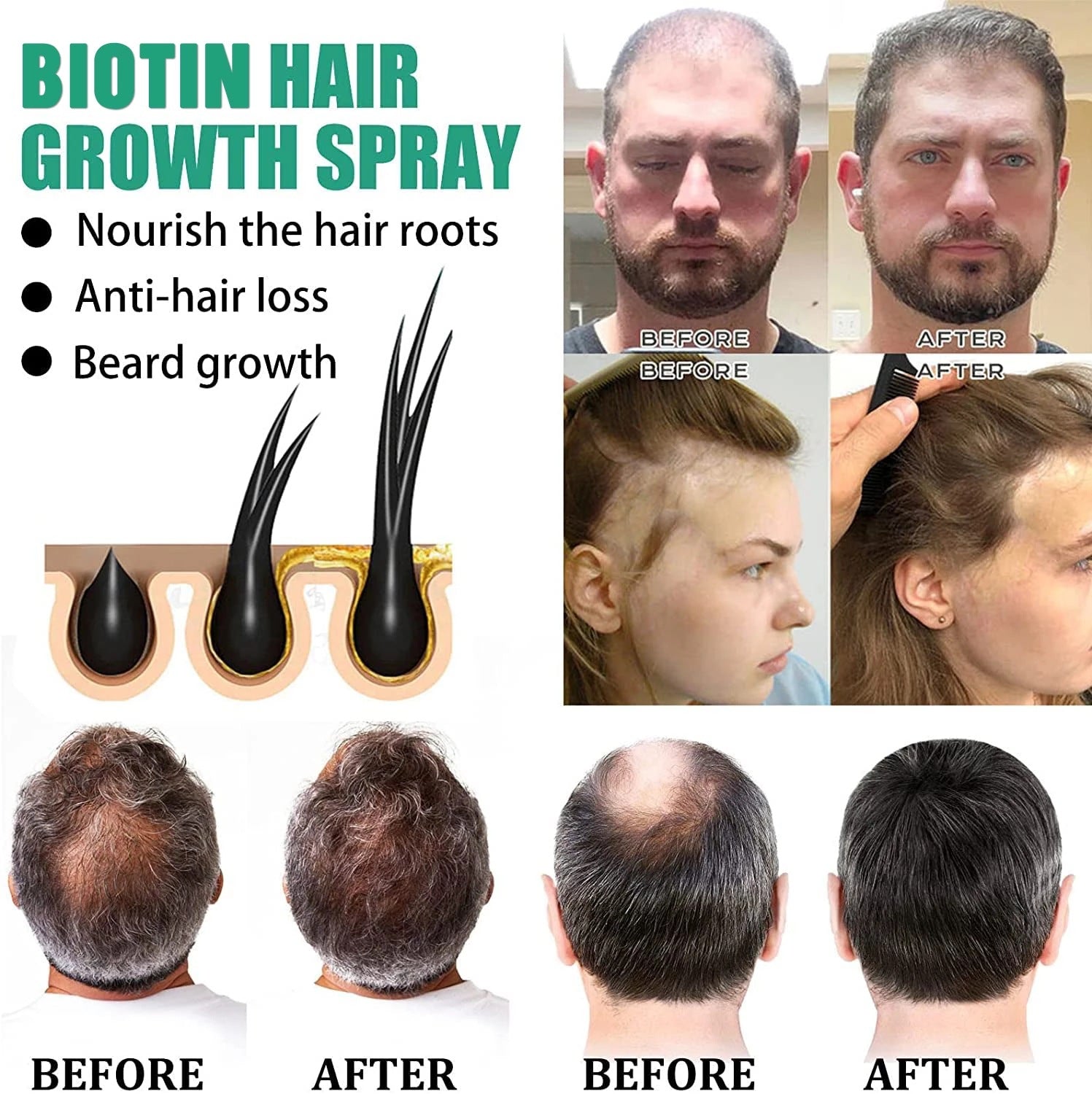 iBeaLee Anti Hair Loss Hair Nourishing Liquid Hair Firming And Hair Increasing