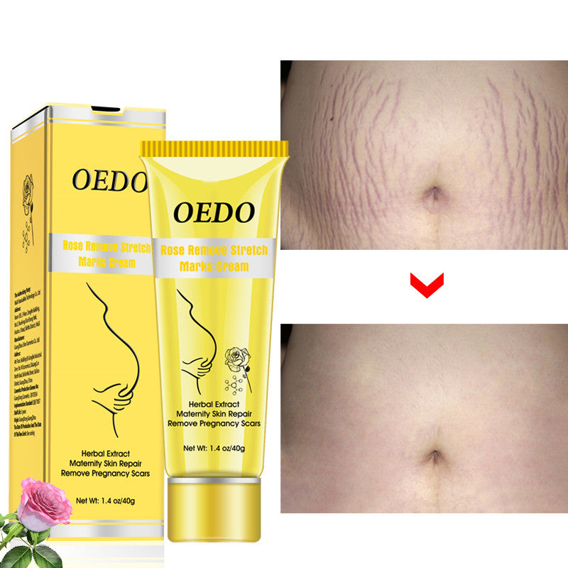 Rose go to stretch marks cream