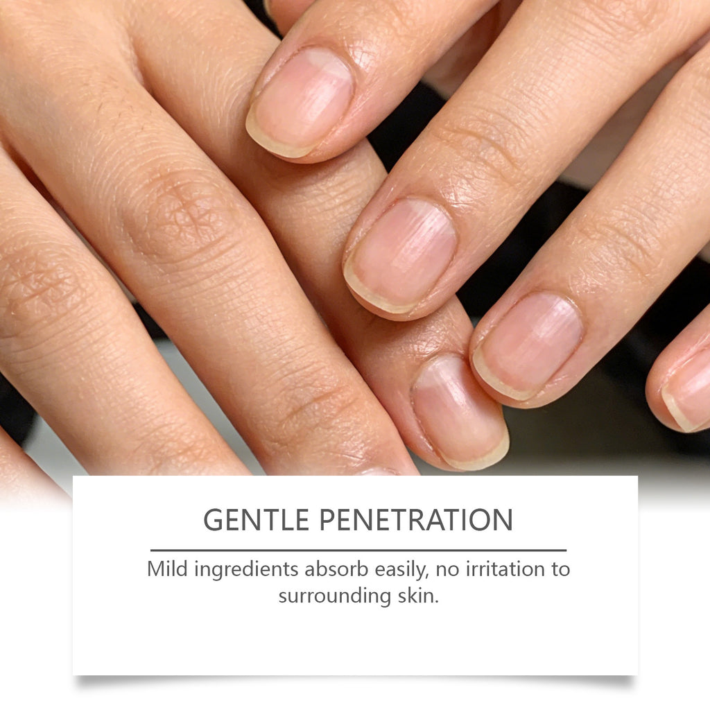 Ximonth Nail Care Patches