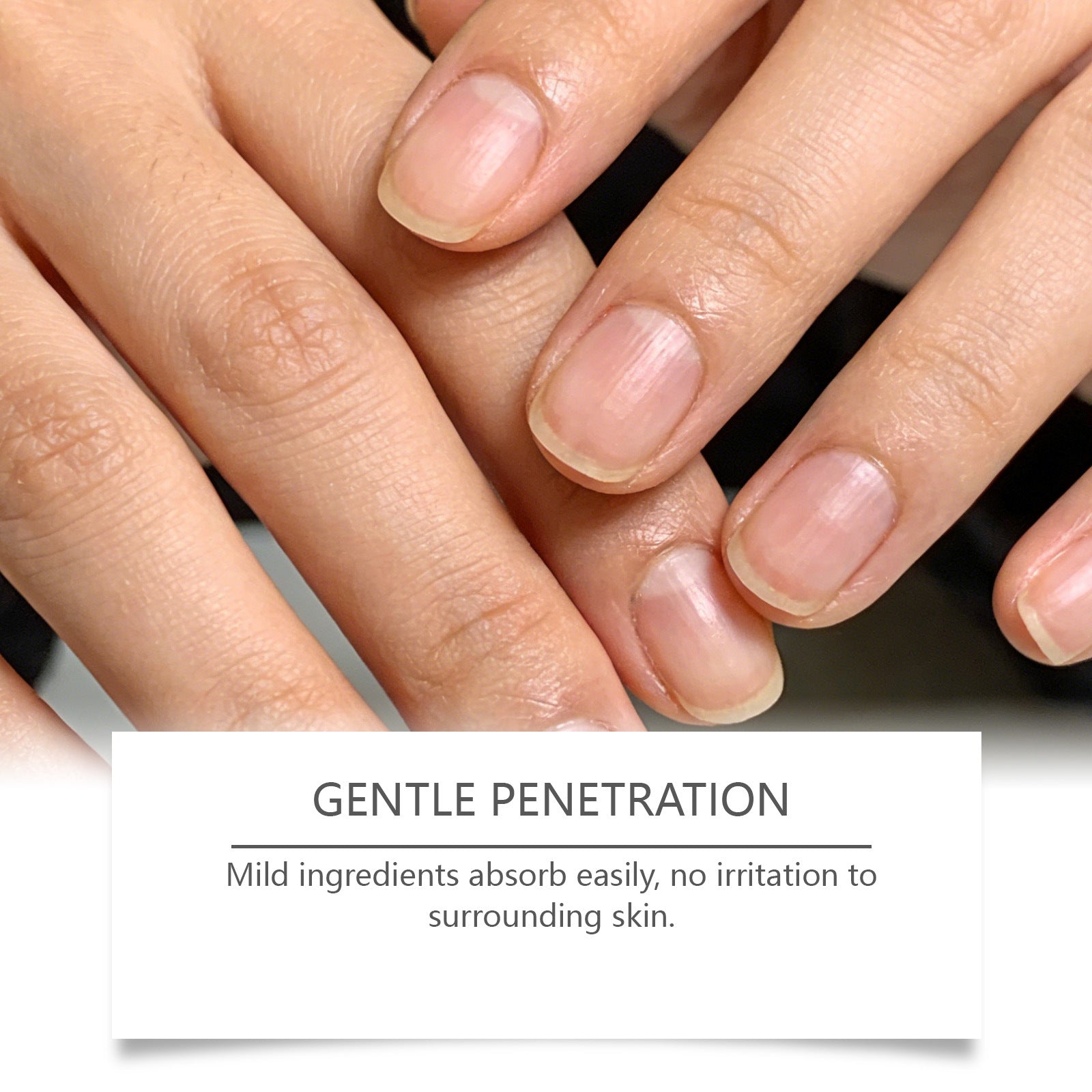 Ximonth Nail Care Patches