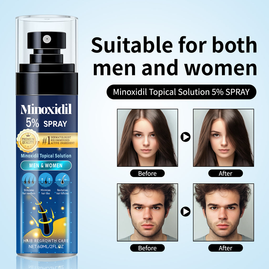 Minoxidil Relieve Hair Thinning And Moisturizing Hair Care Spray