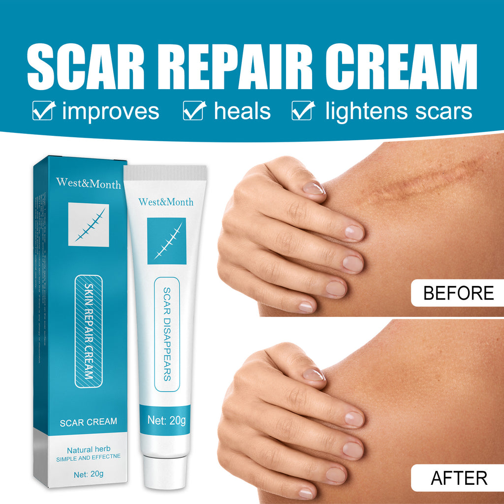 Scar Repair Cream Desalinates Old Scald Burns