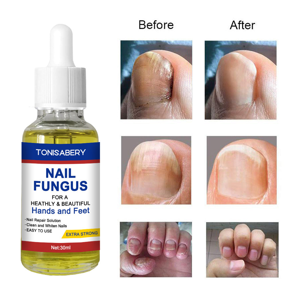 TonisaBery Nail To Remove Nails30 Ml