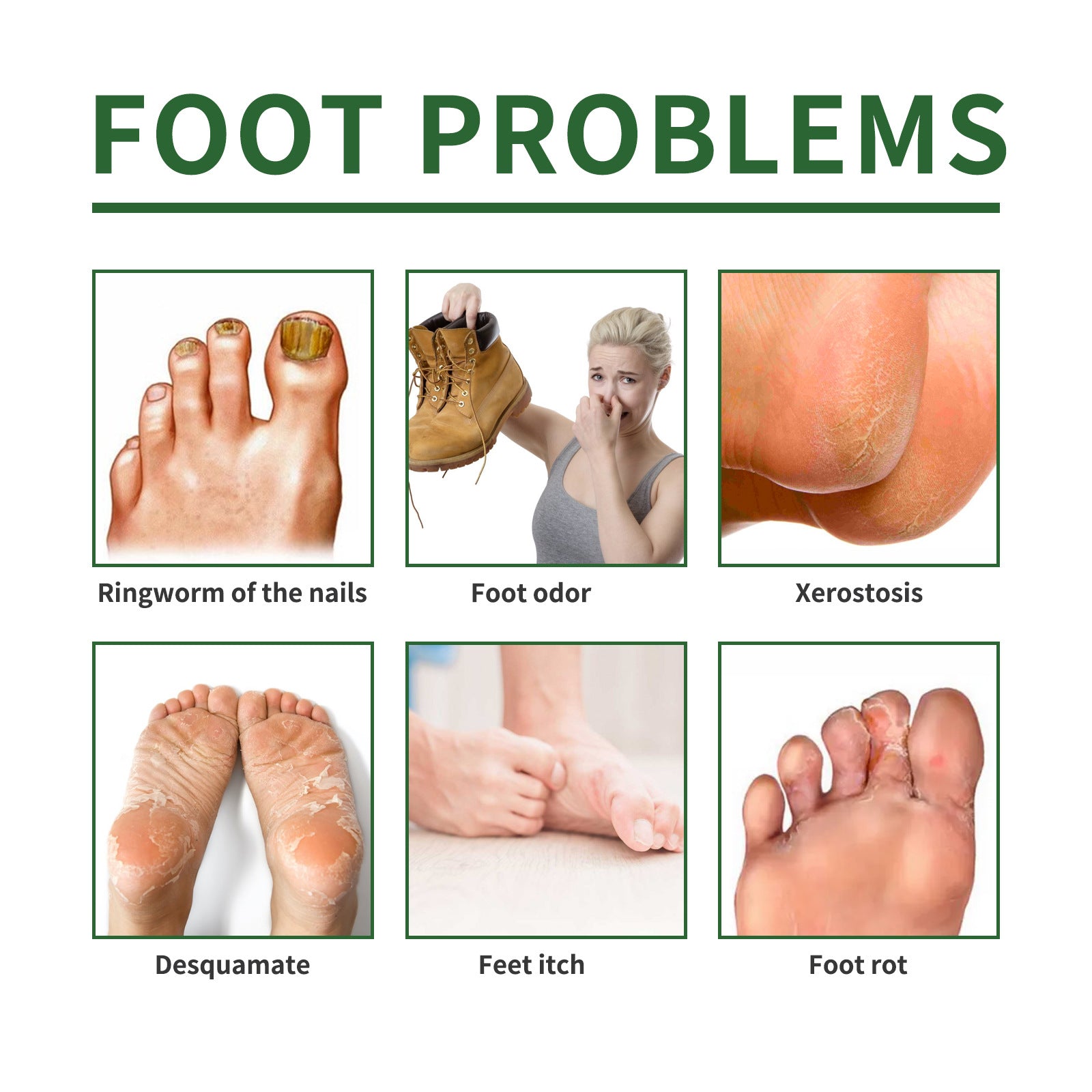 South Moon Nail Repair Foot Mask