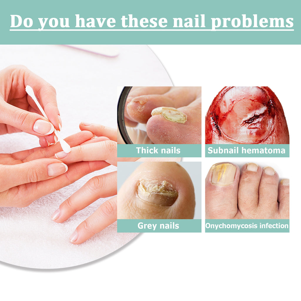 Nail Repair Pen Nail Removal Dead Skin Barbed Moisturizing Repair Pen
