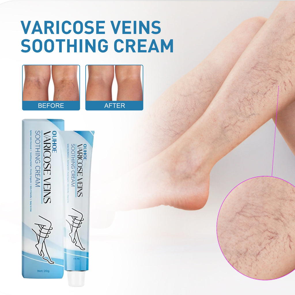 Intravenous Repair Cream Relieve Leg Pain Leg Massage Soreness Maikang Neck Cream
