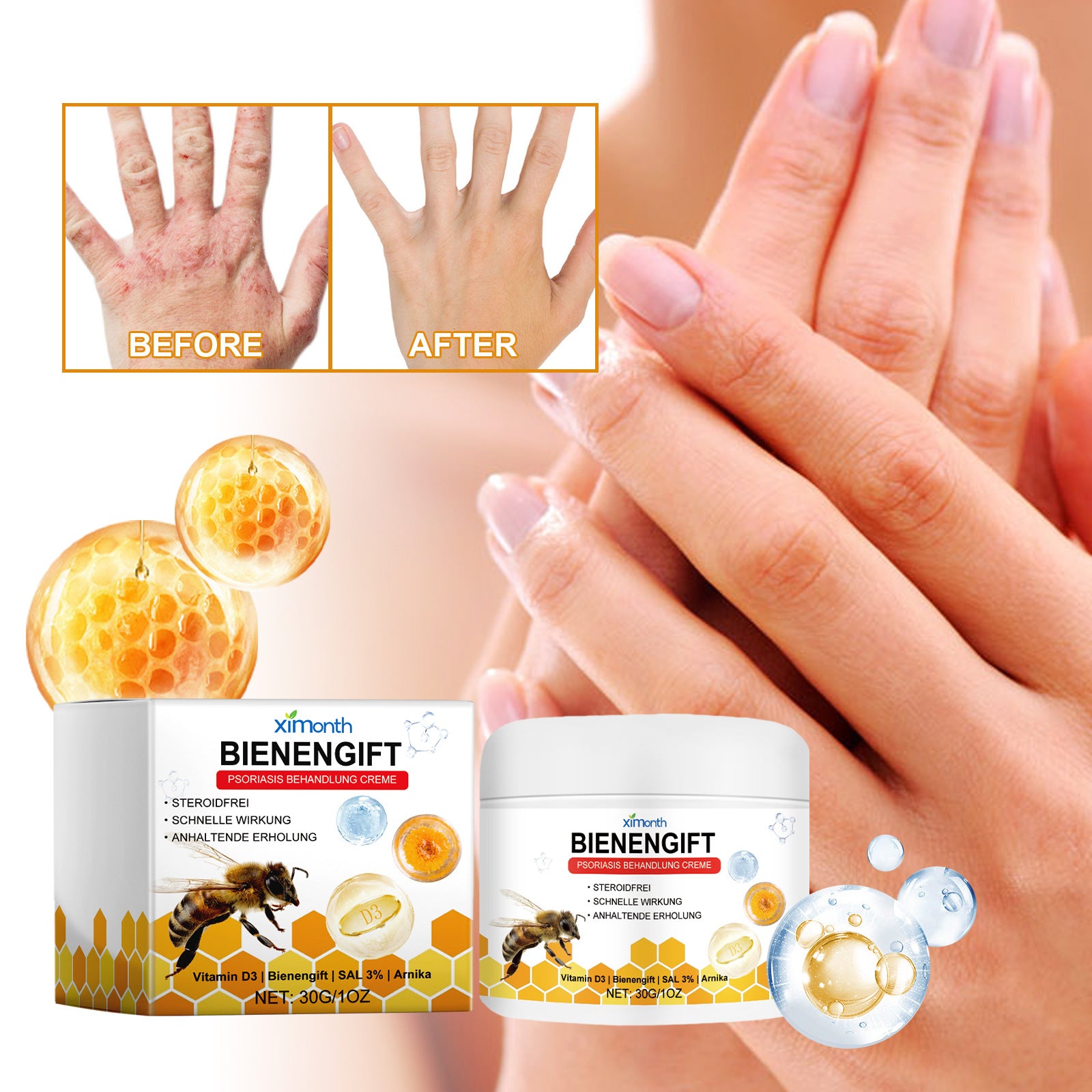 Relieve Itching And Redness Neck Cream