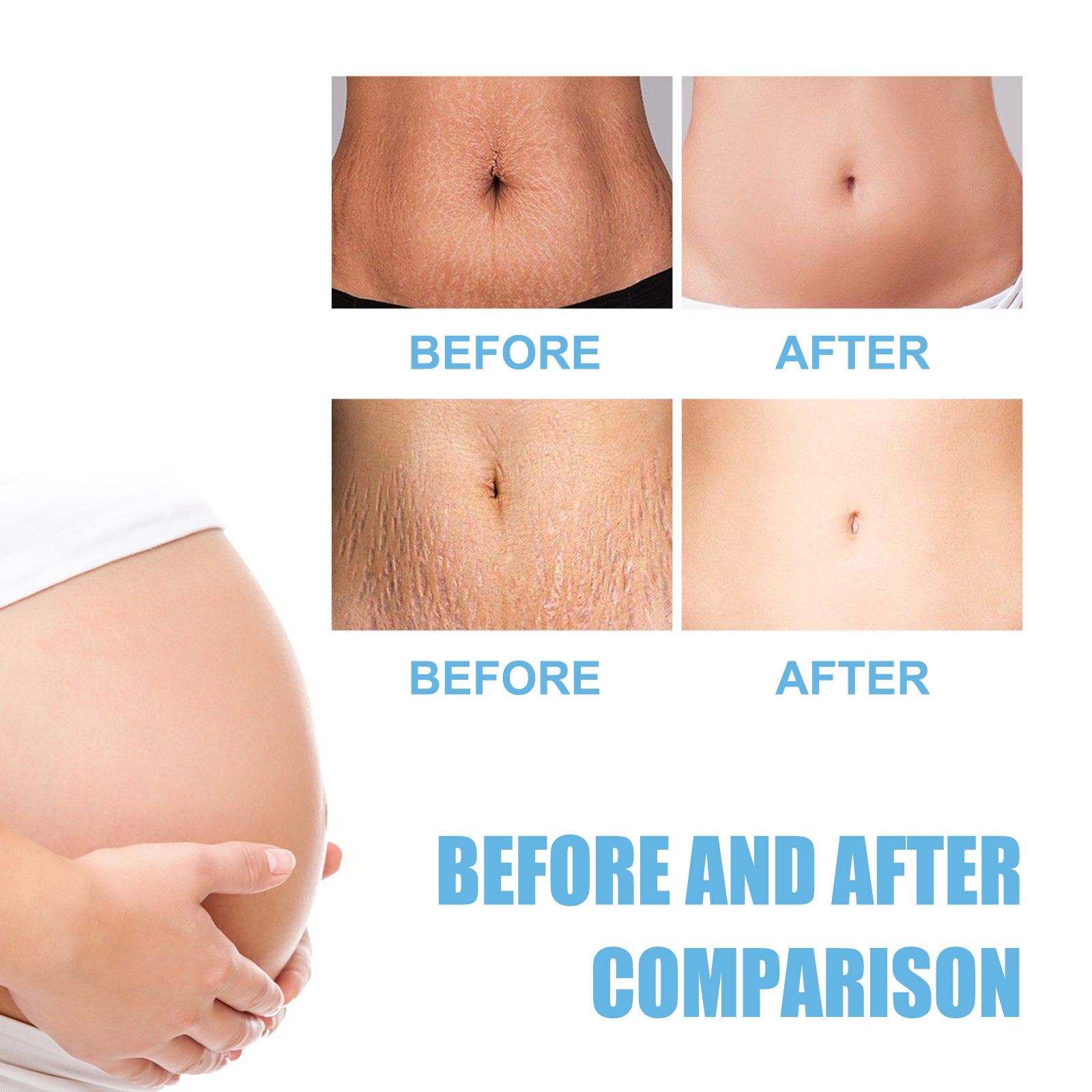 Moisturizing Skin Rejuvenation Cream