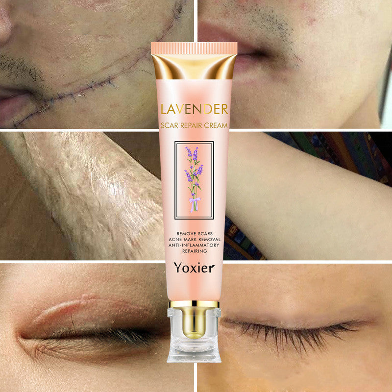 Lavender Scar Repair Cream
