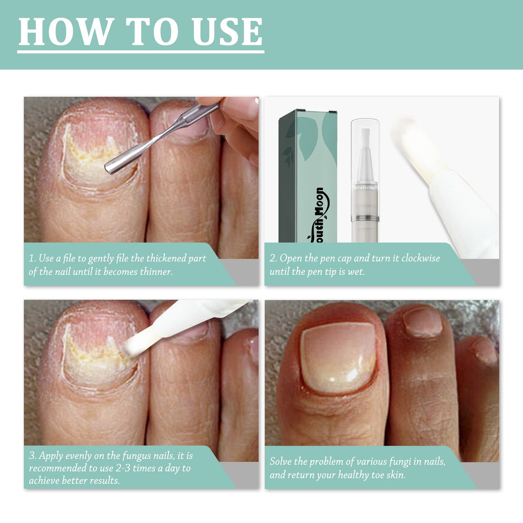 South Moon Nail Repair Pen Nail Removal Dead Skin Barbed Gray Nail Care Nutrition Moisturizing Repair Pen