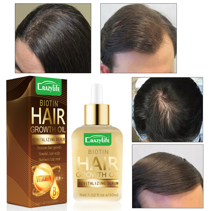 CrazyLife Biotin Hair Hair Care Essential Oil 30ml Soft And Refreshing