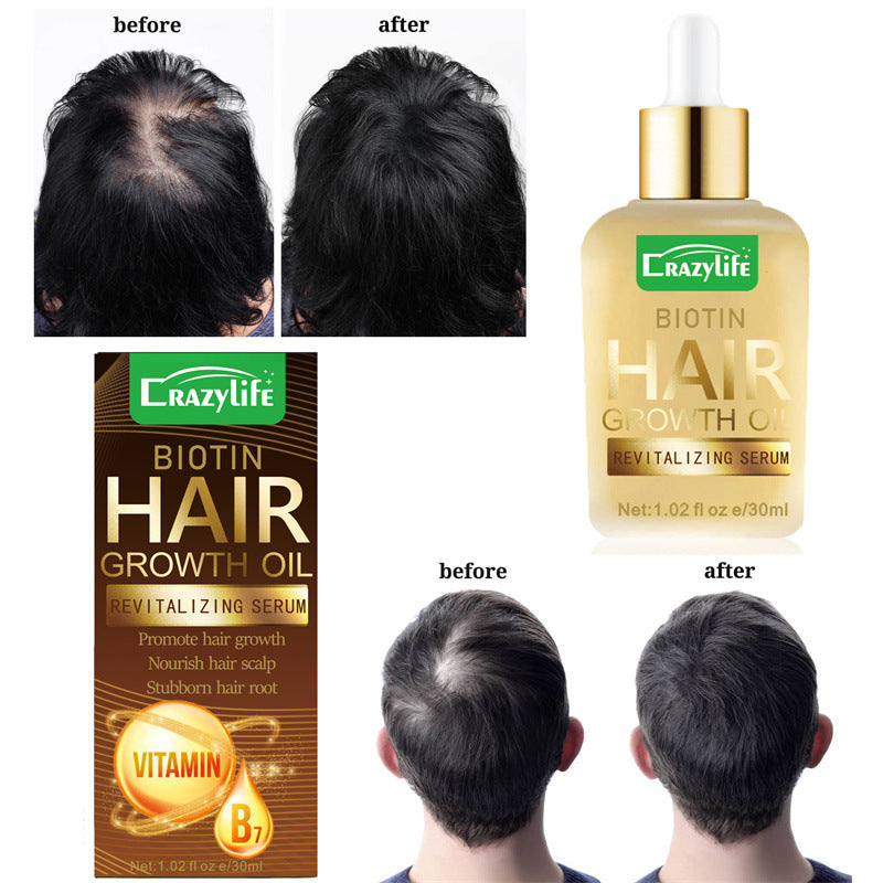 CrazyLife Biotin Hair Hair Care Essential Oil 30ml Soft And Refreshing
