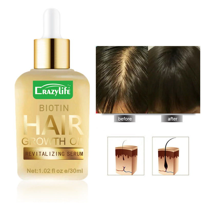 CrazyLife Biotin Hair Hair Care Essential Oil 30ml Soft And Refreshing