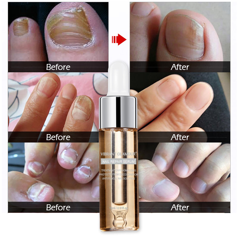 Vibrant Glamour Nail repair and maintenance liquid