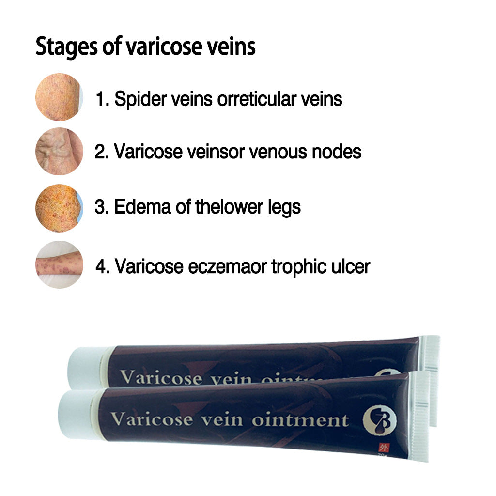 Nursing vein cream