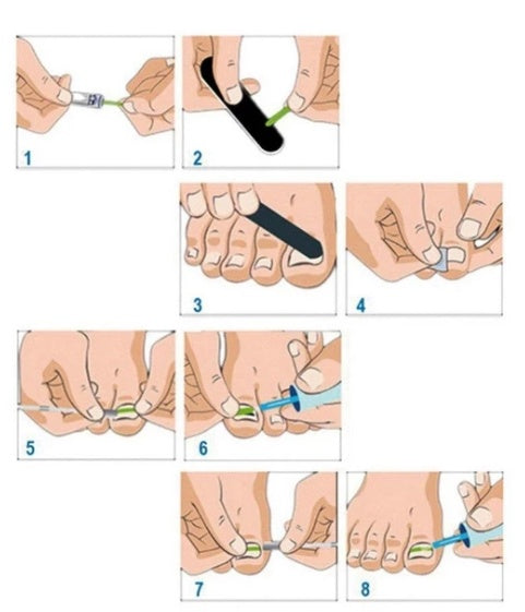 Ginail Nail patch