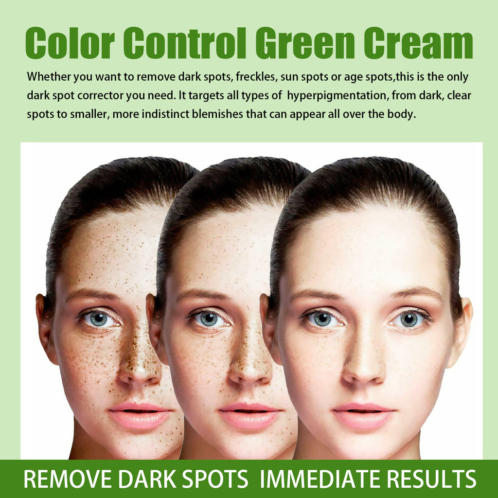 Lighten Spots Green Cream Freckles Decompose Pigments